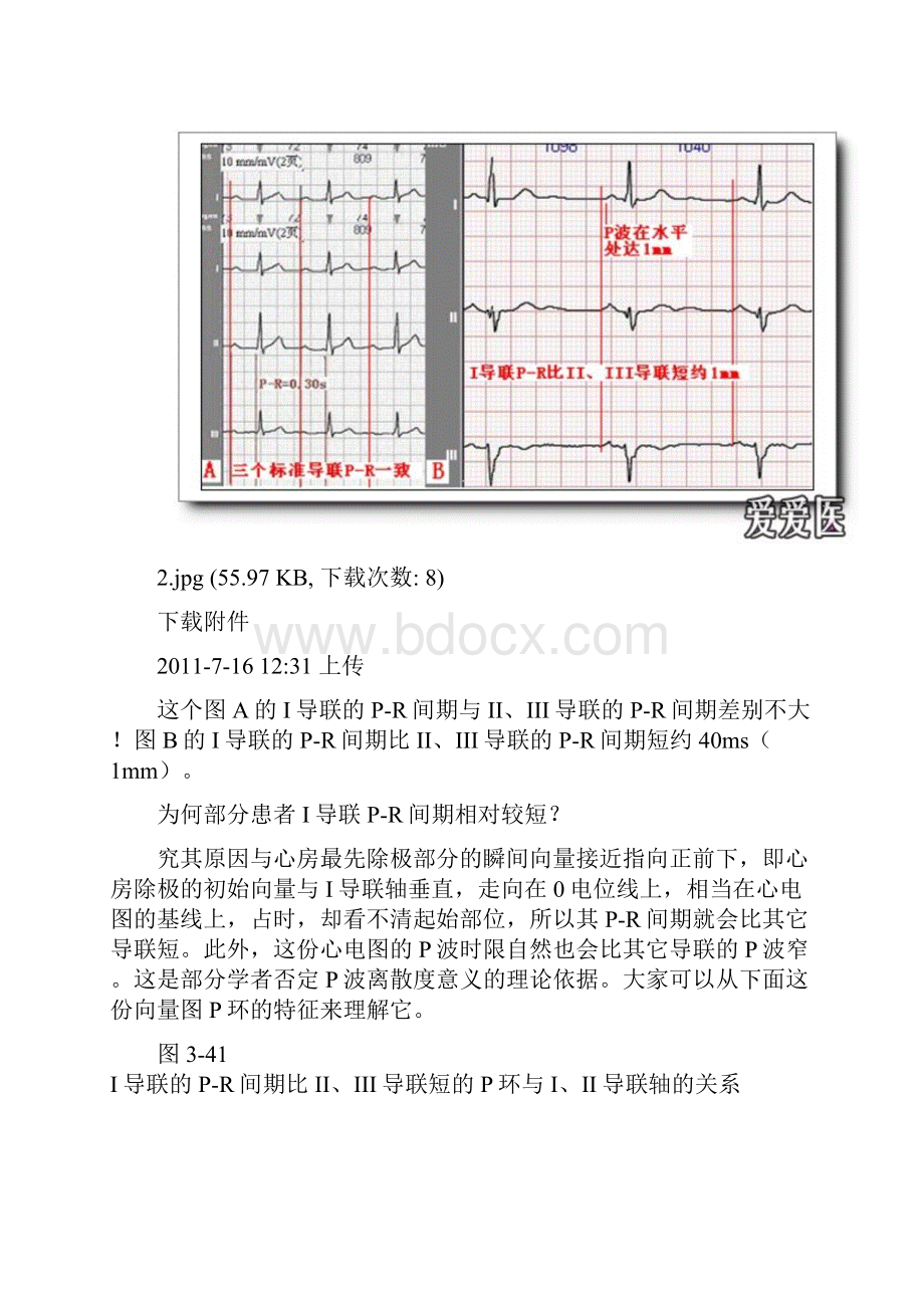 整理第六讲PR间期与PR段分析.docx_第3页