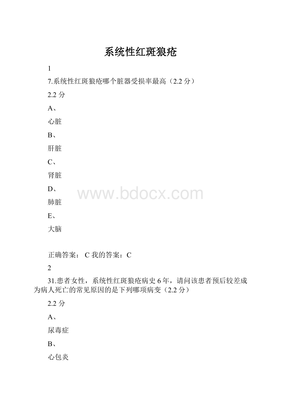 系统性红斑狼疮.docx_第1页