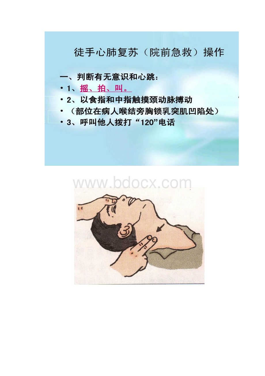 心肺复苏包扎操作步骤精.docx_第2页