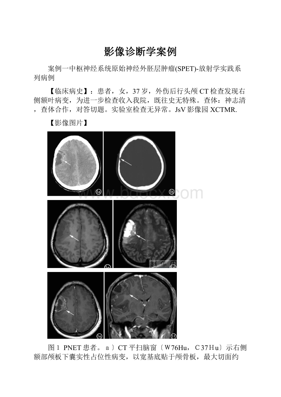 影像诊断学案例.docx_第1页