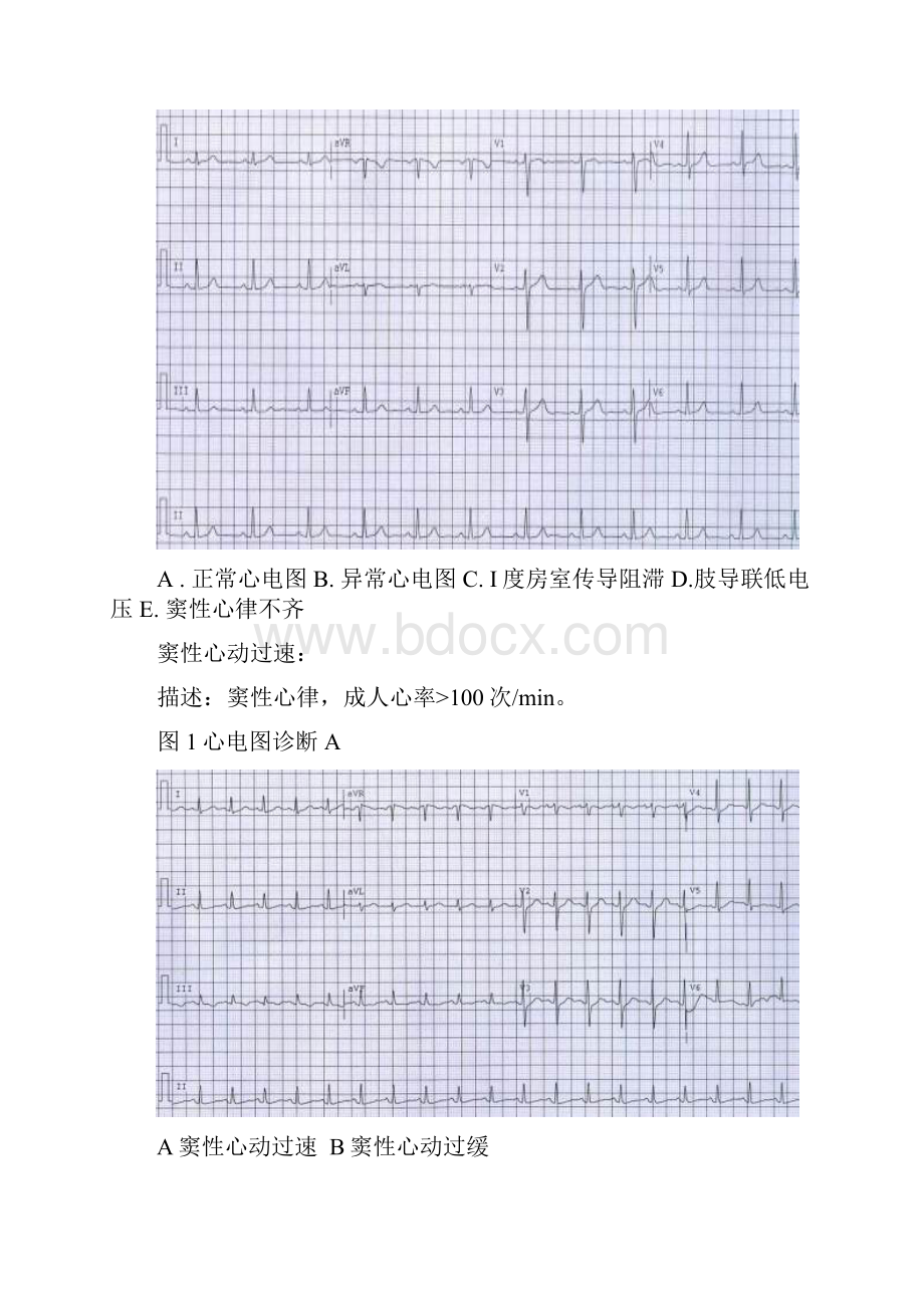 心电图读片习题.docx_第3页