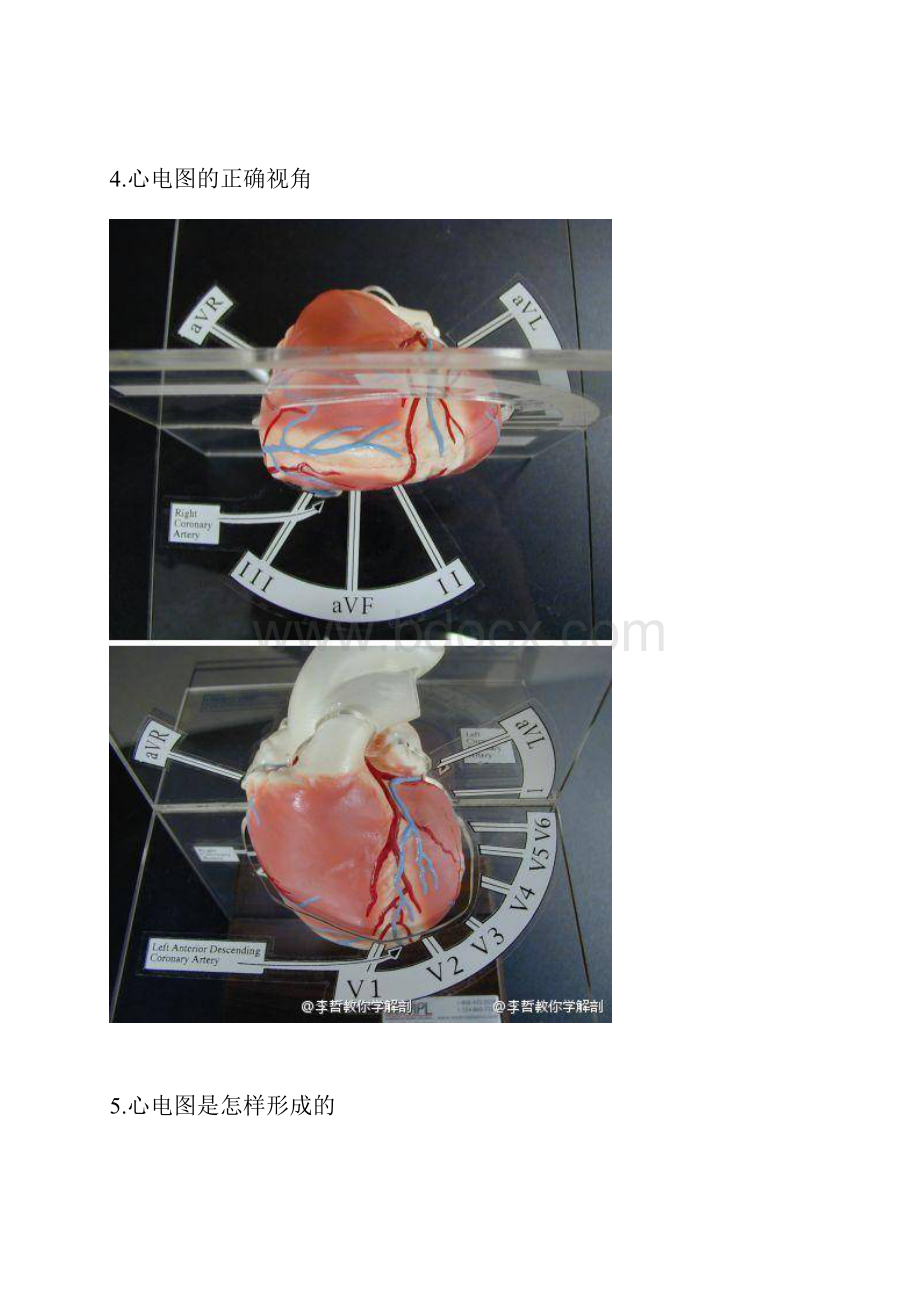 心血管疾病图文详解.docx_第3页