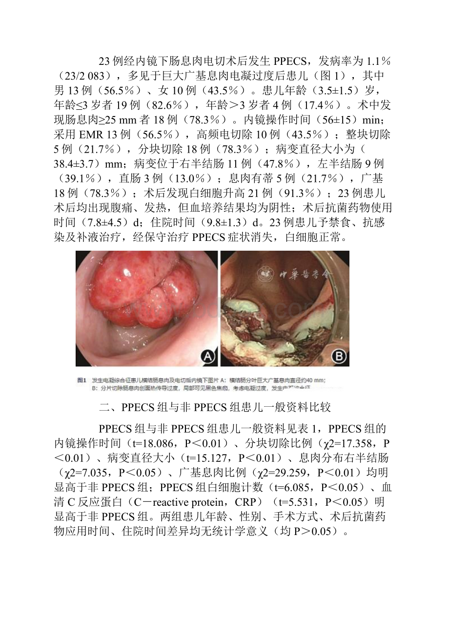 儿童肠息肉术后电凝综合征的临床特征及危险因素分析全文.docx_第3页