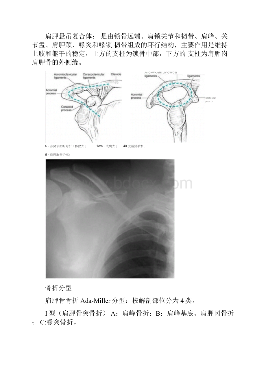 肩胛骨骨折的内固定手术技巧.docx_第3页