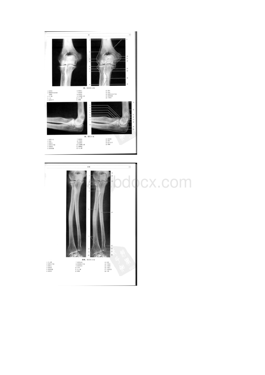 上肢X线解剖.docx_第3页