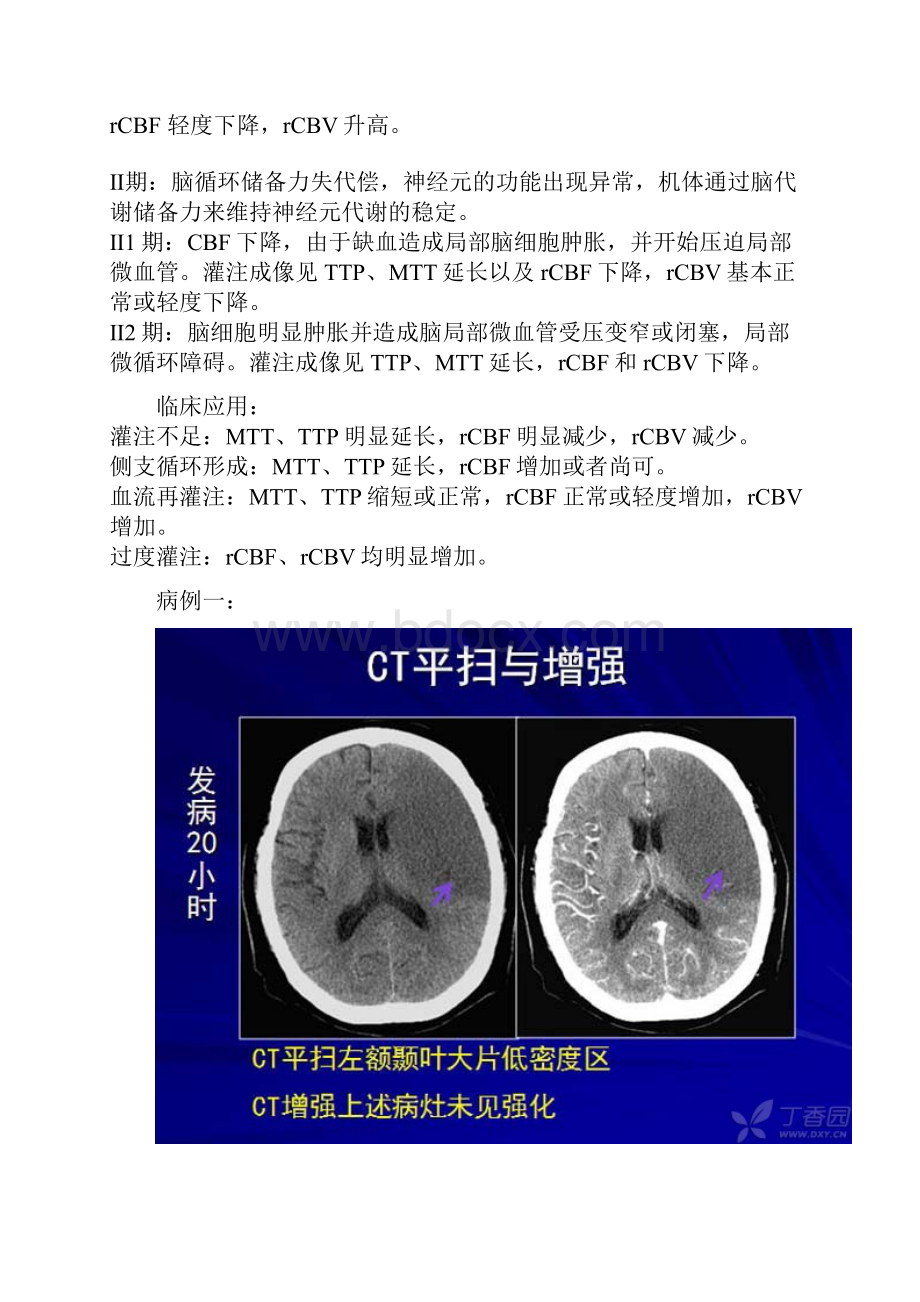 最新脑缺血CT灌注基础知识.docx_第3页