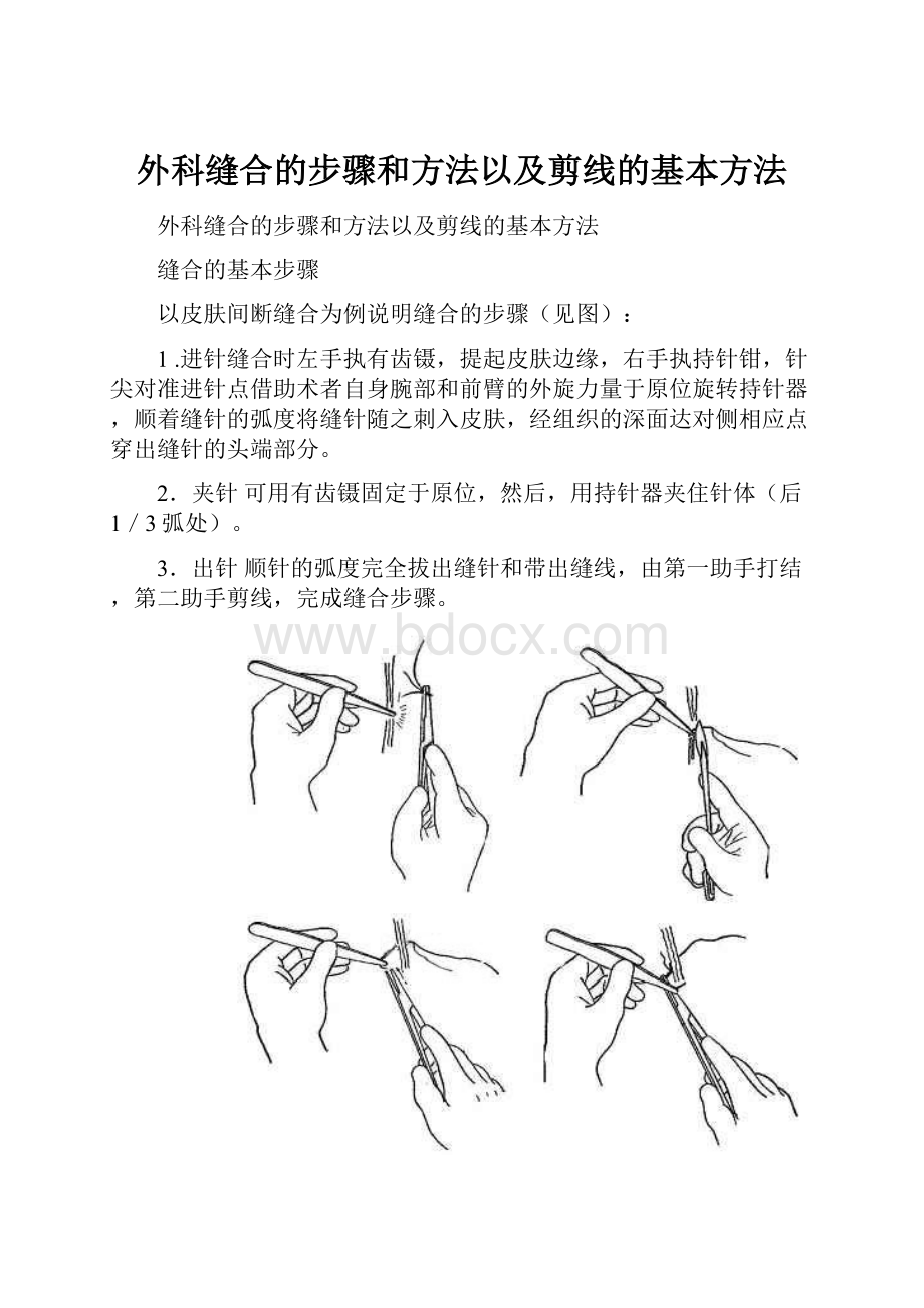 外科缝合的步骤和方法以及剪线的基本方法.docx