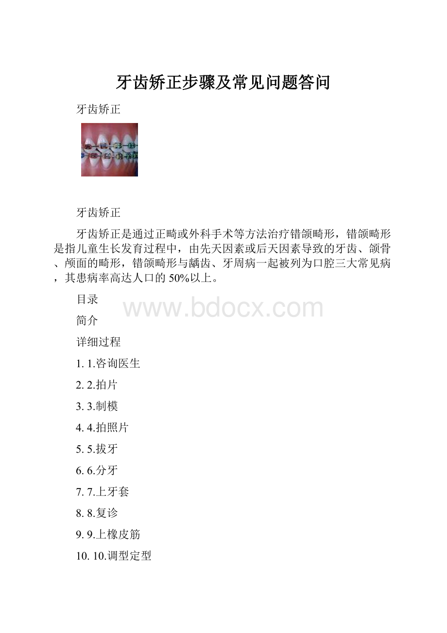 牙齿矫正步骤及常见问题答问.docx