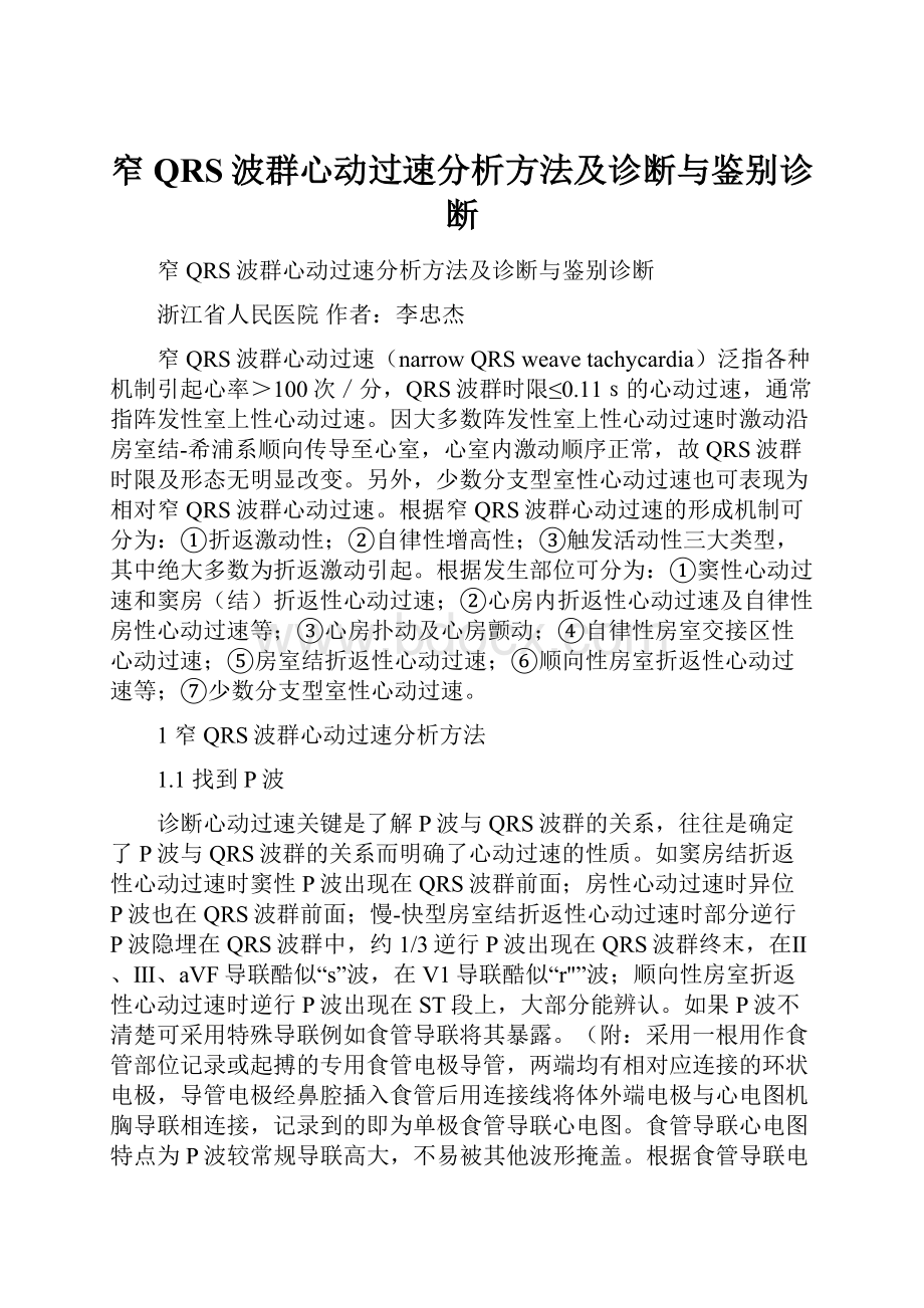 窄QRS波群心动过速分析方法及诊断与鉴别诊断.docx