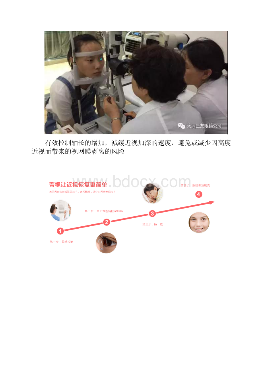 菁视 角膜塑形镜.docx_第2页