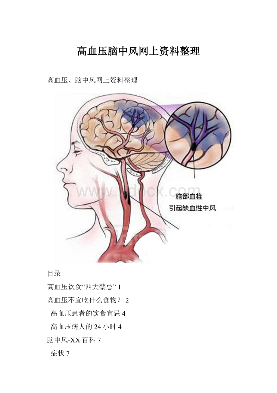 高血压脑中风网上资料整理.docx_第1页