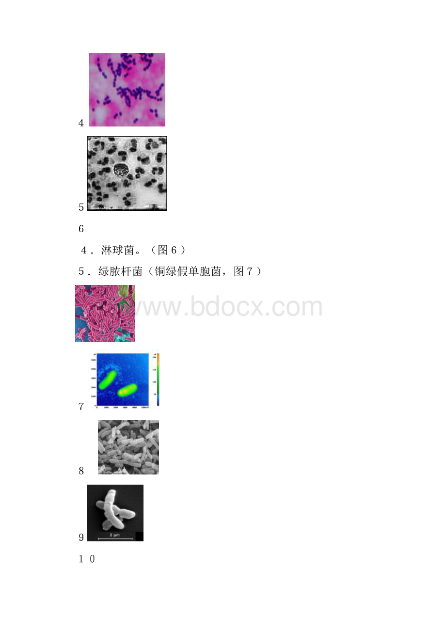 眼部感染与炎症.docx_第3页