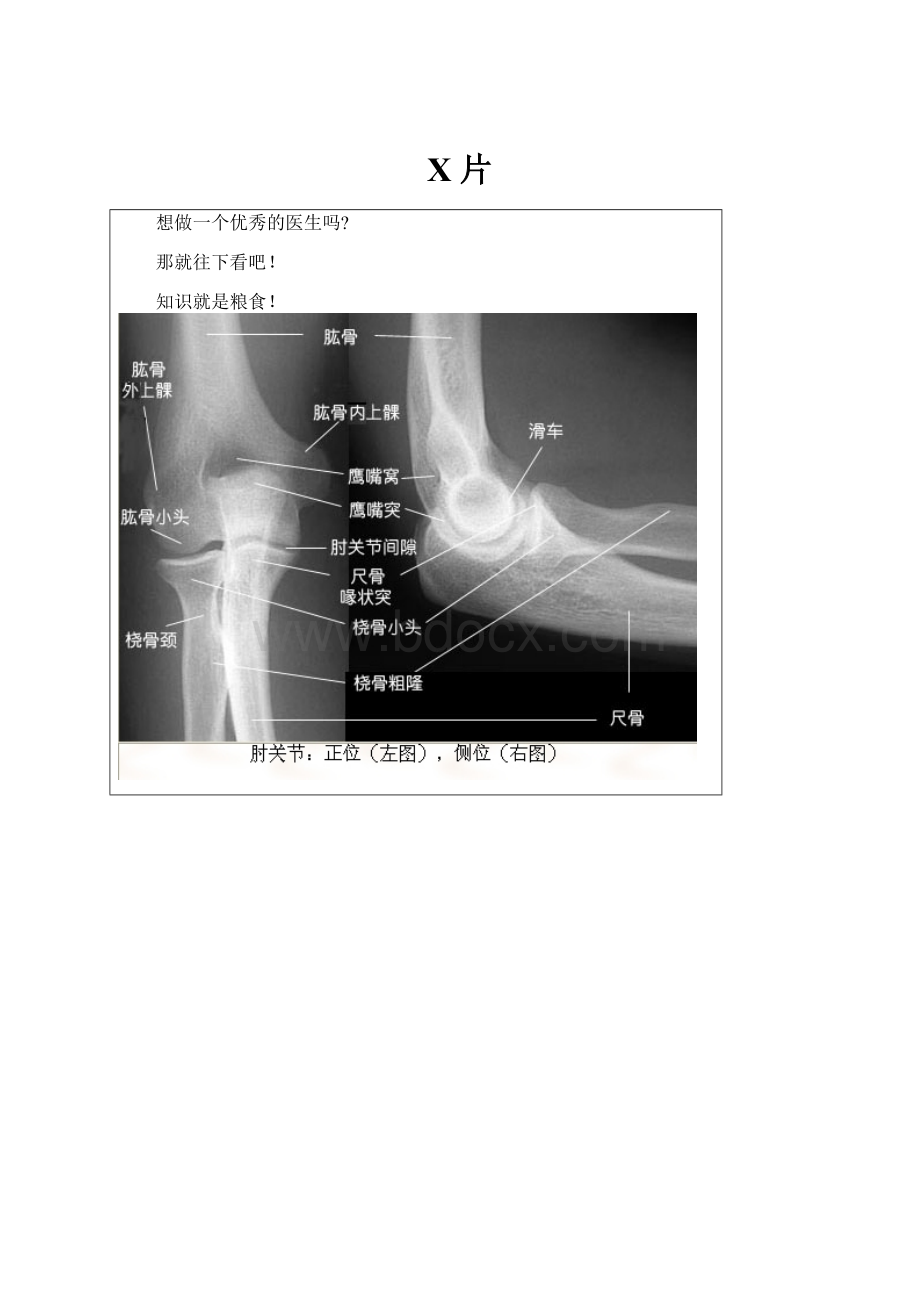 X片.docx_第1页