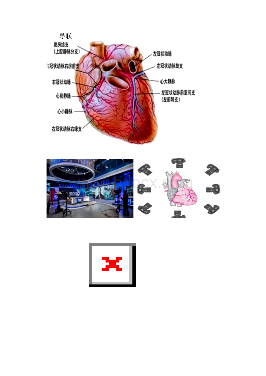 心电图诊断.docx_第3页