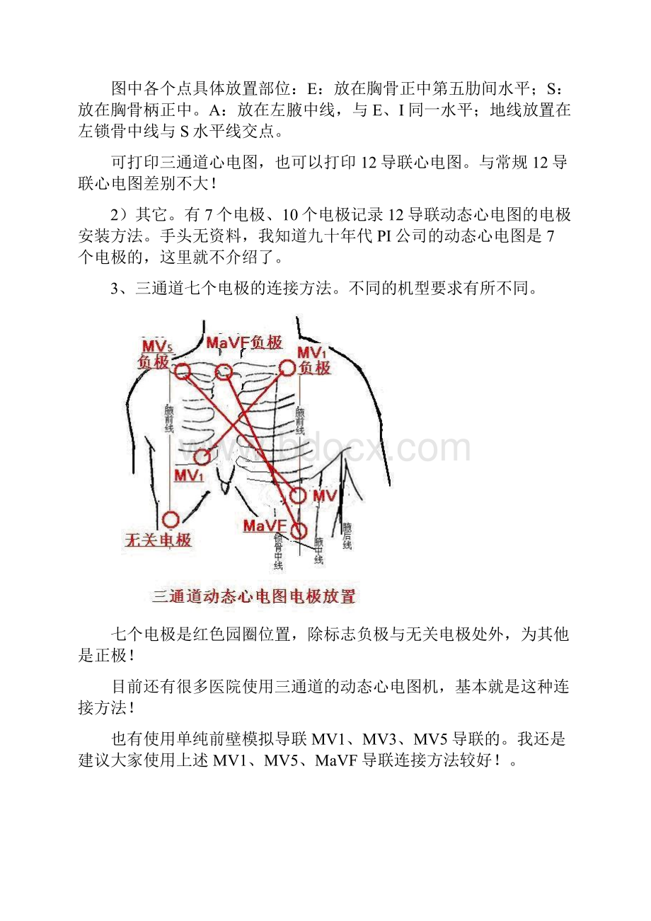 另类心电图讲义16动态心电图1.docx_第3页