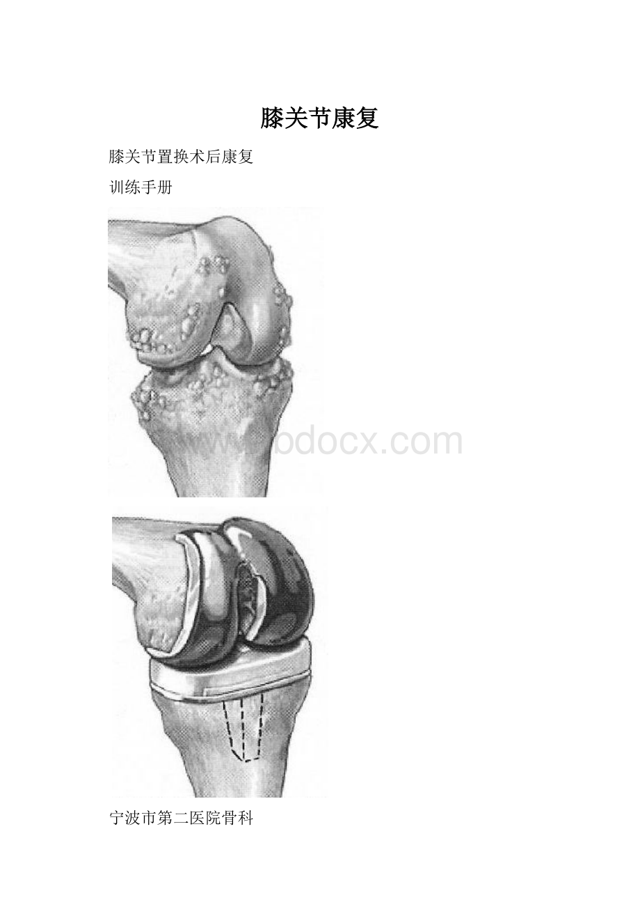 膝关节康复.docx_第1页