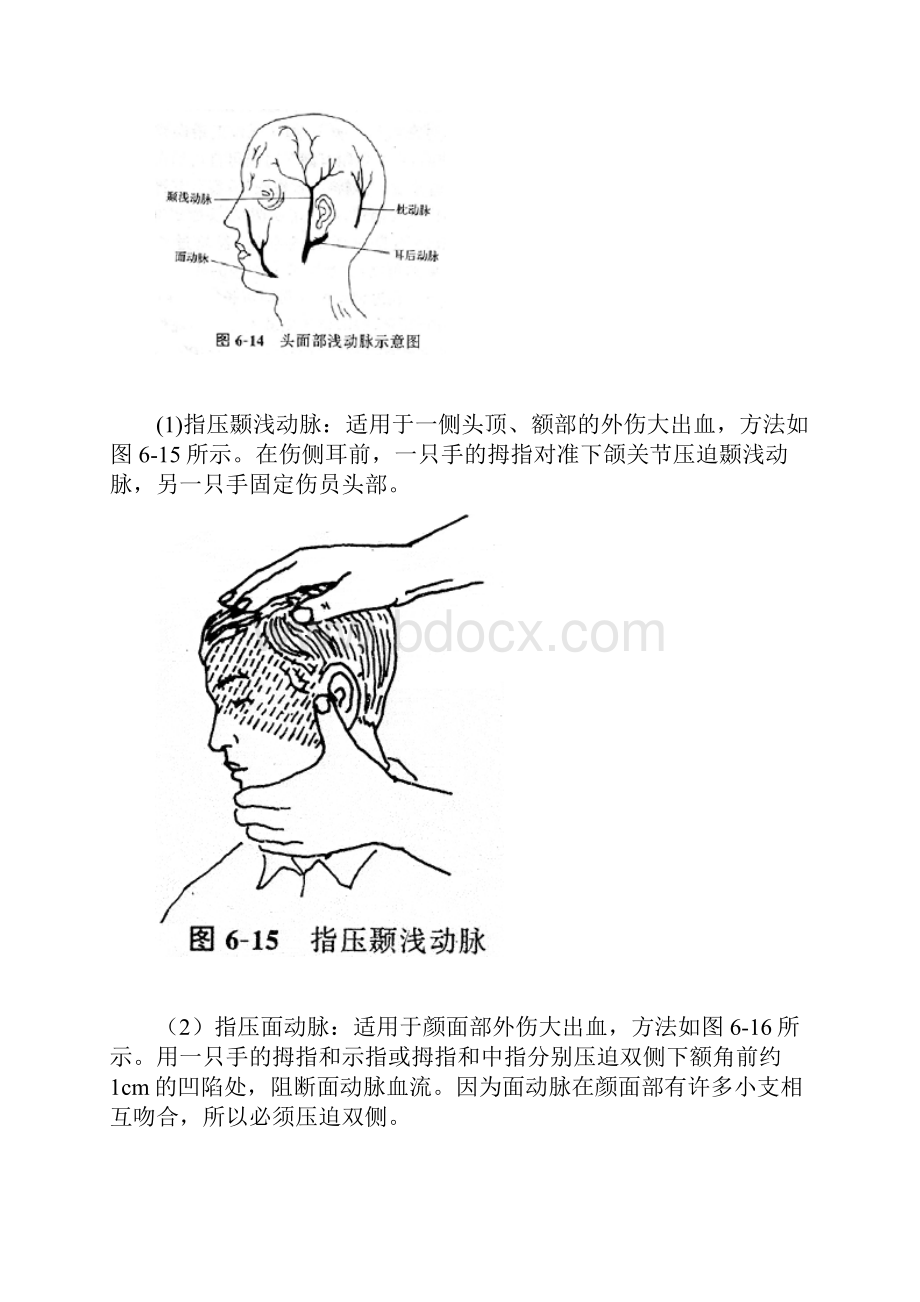 现场外伤急救技术主要指止血包扎固定技术.docx_第2页