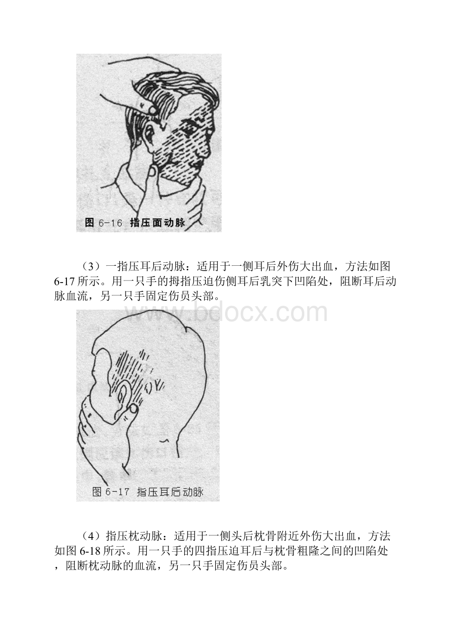 现场外伤急救技术主要指止血包扎固定技术.docx_第3页