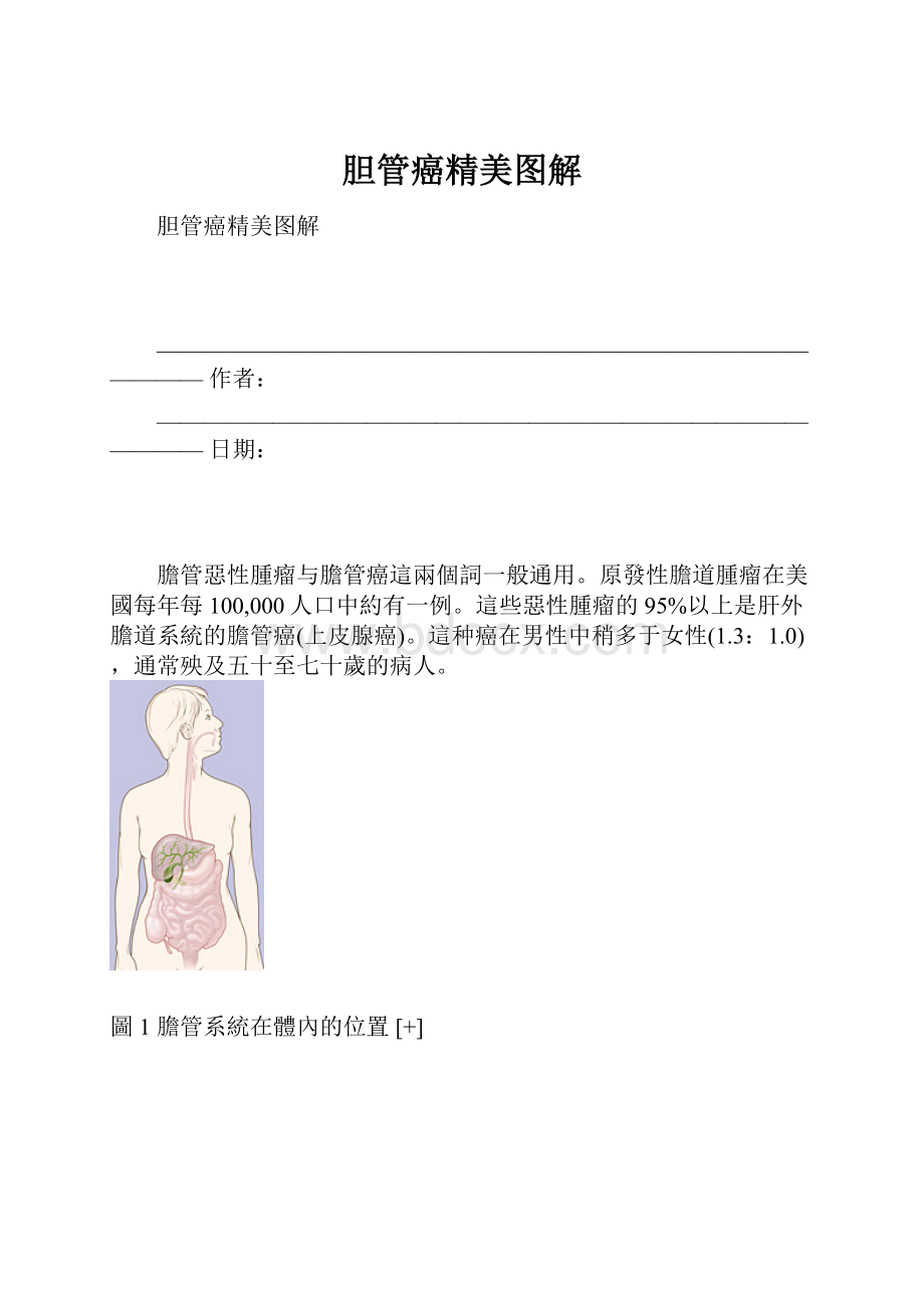 胆管癌精美图解.docx_第1页