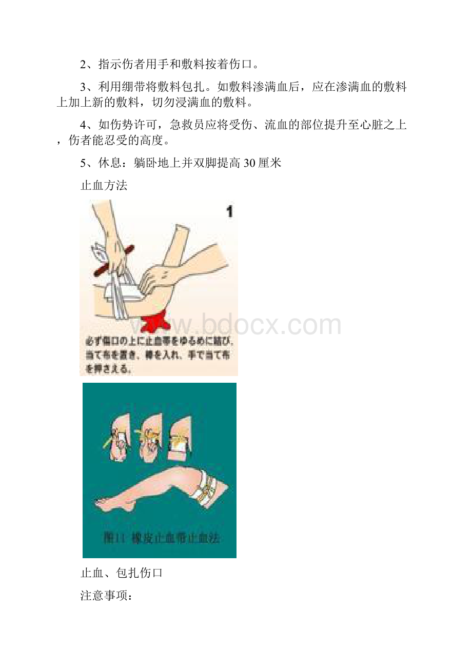 常见应急救护常识.docx_第2页