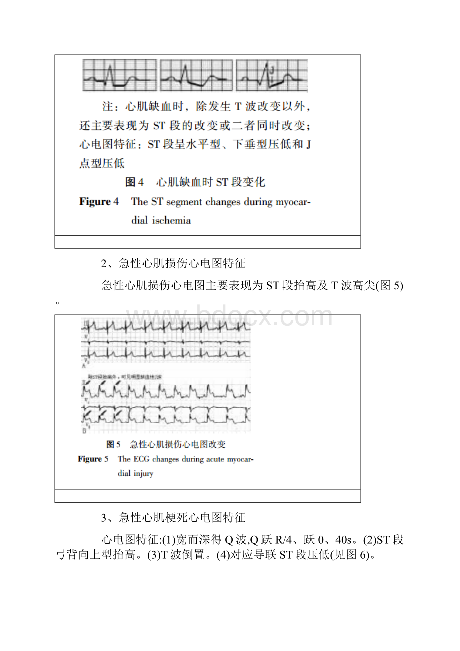 详解临床常见心电图危急值识别.docx_第3页