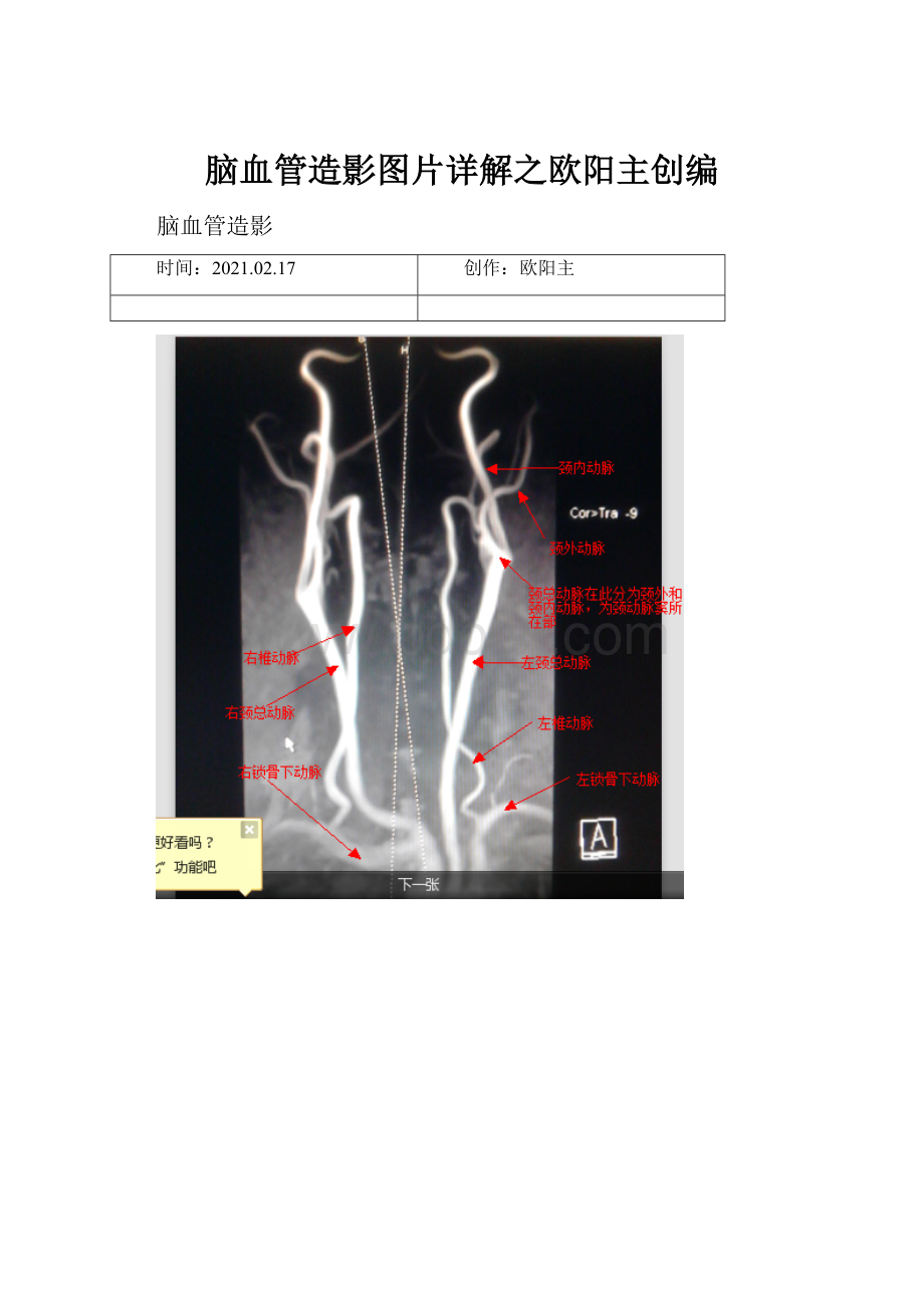 脑血管造影图片详解之欧阳主创编.docx