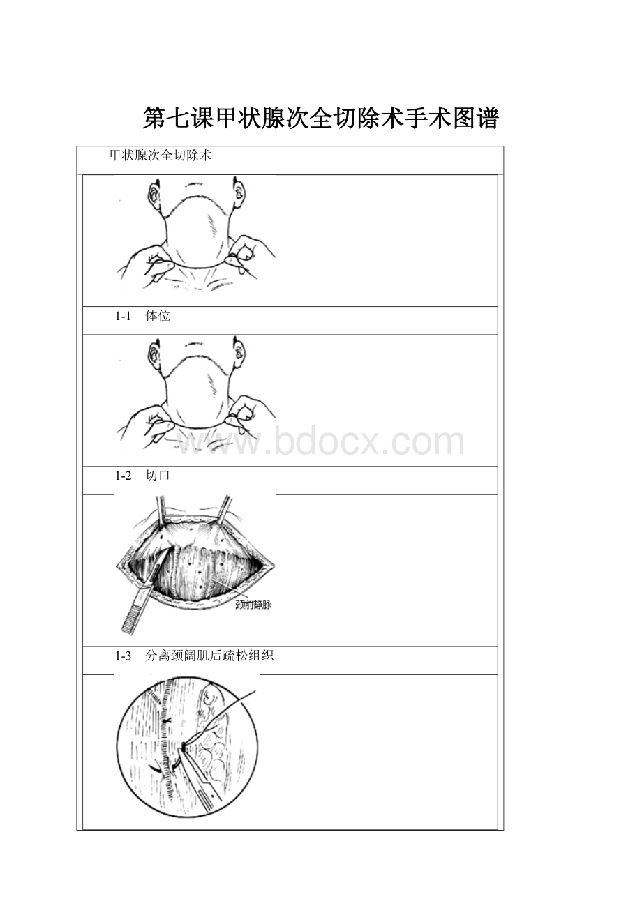 第七课甲状腺次全切除术手术图谱.docx_第1页