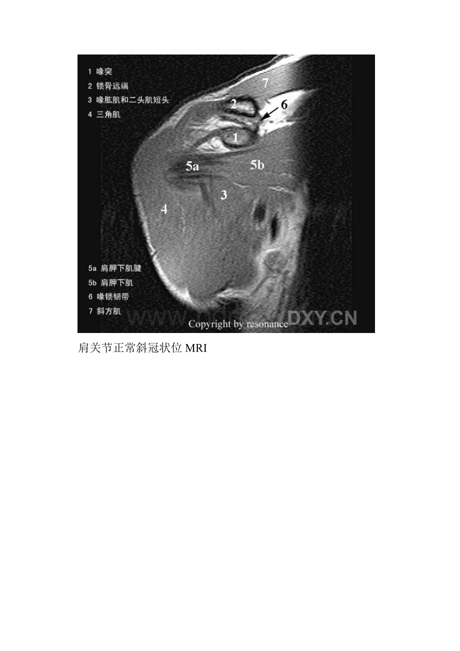 肩关节正常MRI解剖图谱.docx_第3页