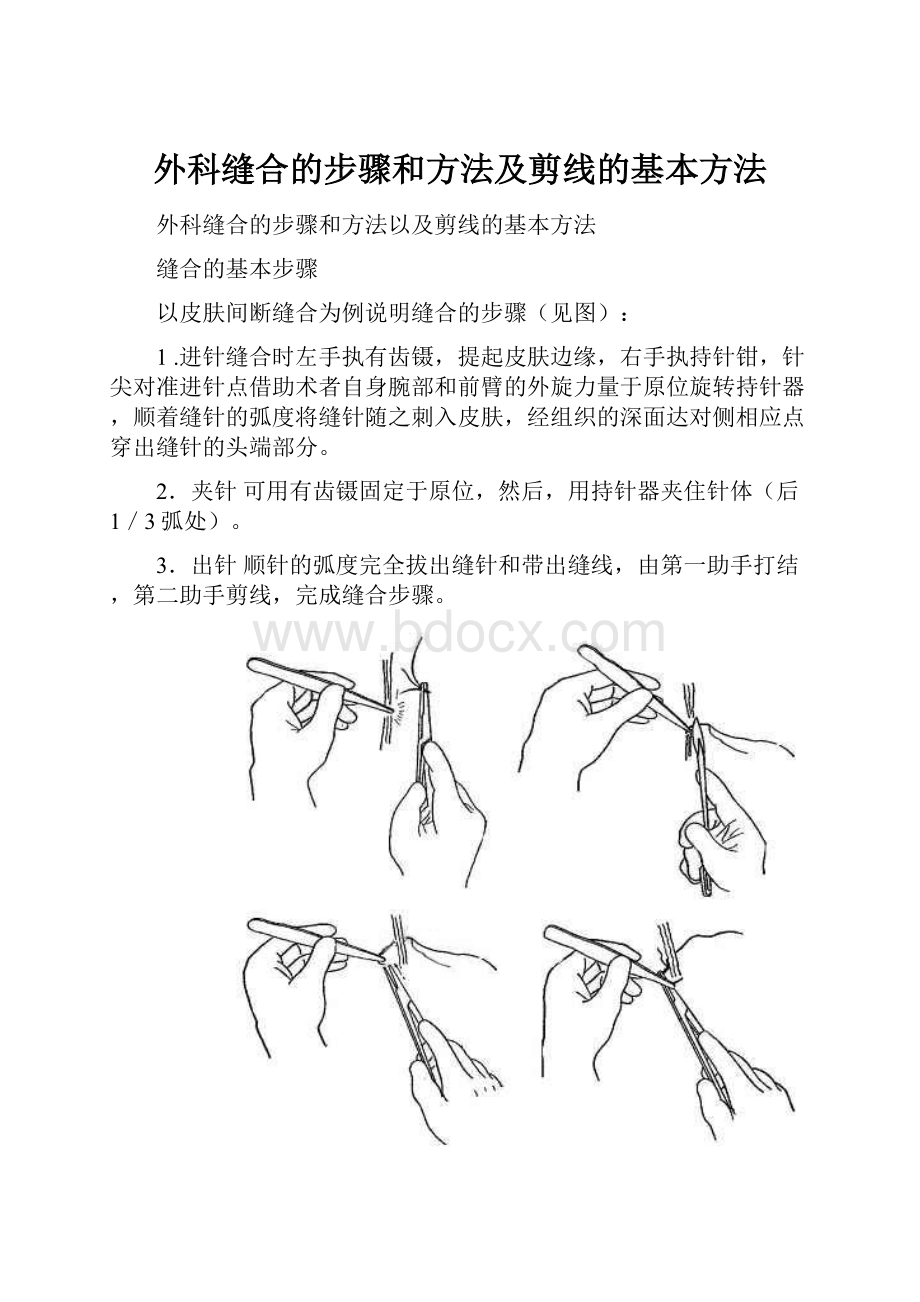 外科缝合的步骤和方法及剪线的基本方法.docx