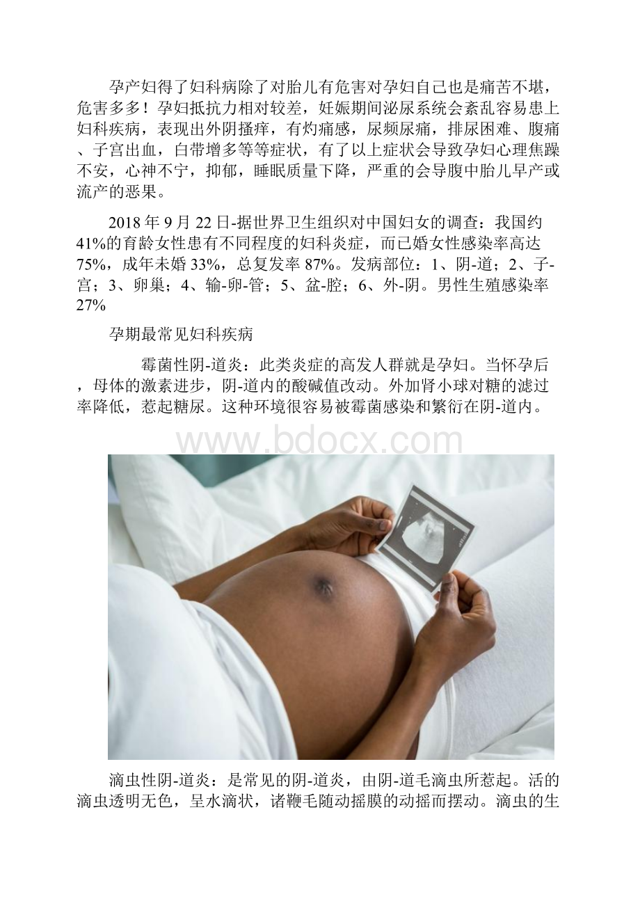 孕期下面痒怎么回事孕期奇痒难受医生再三追问才说出真相.docx_第2页