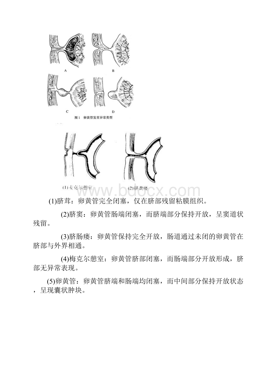 卵黄管残留畸形.docx_第2页