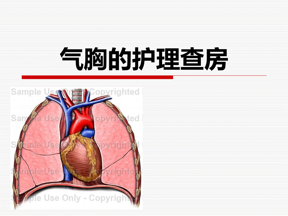 气胸的护理查房.ppt_第1页