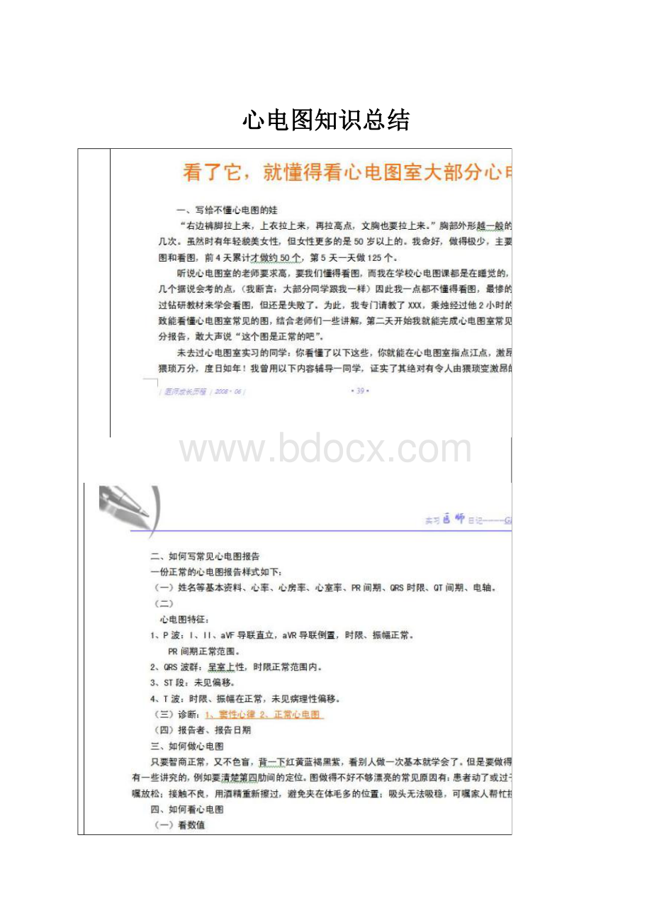 心电图知识总结.docx