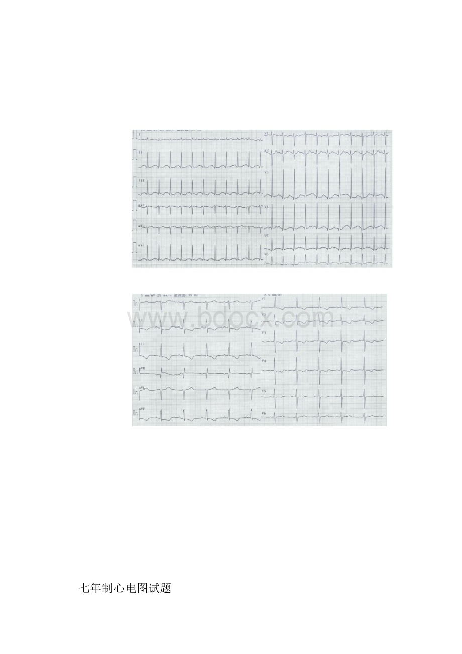 心电图试题及标准答案.docx_第2页