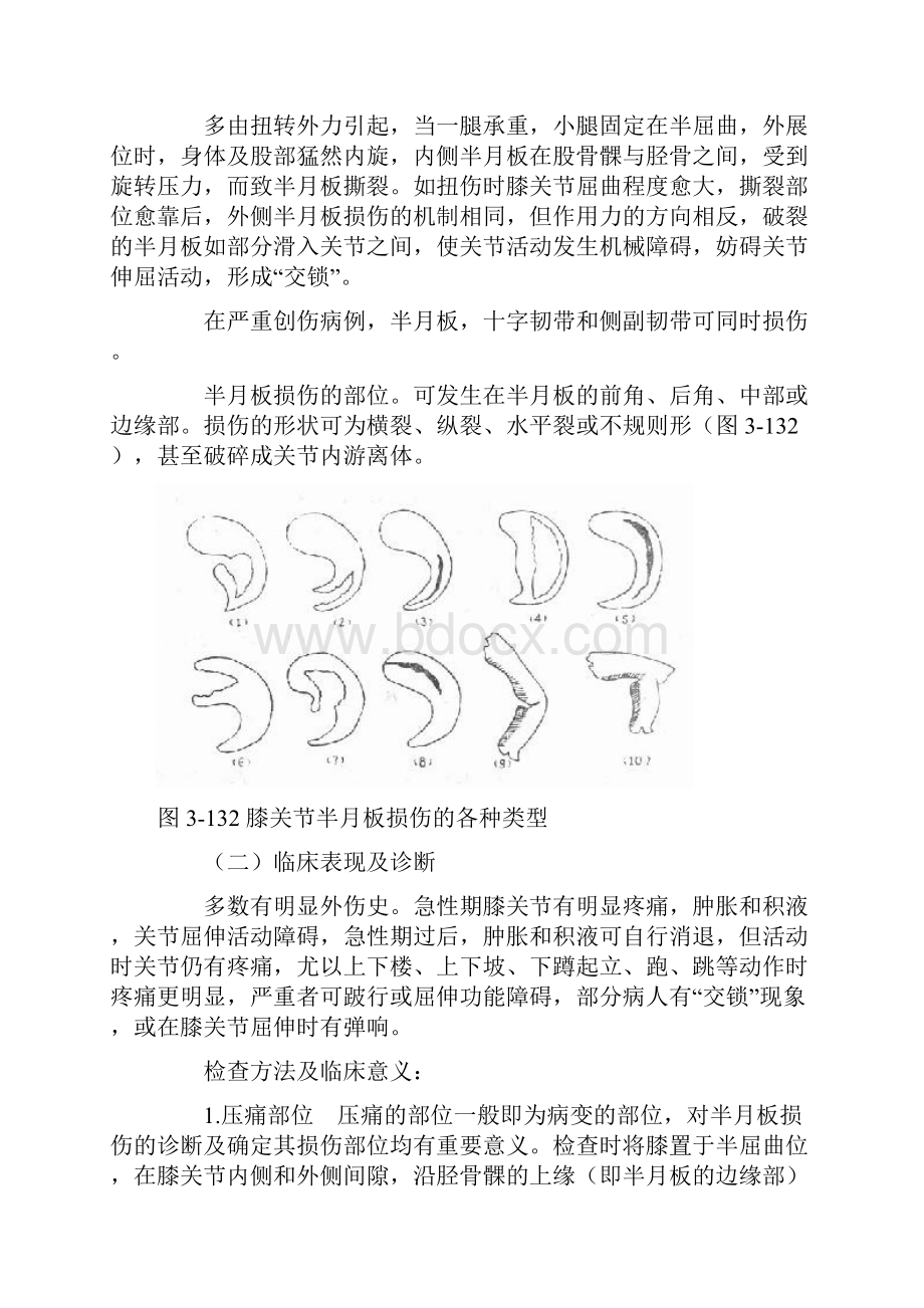 膝关节常见损伤.docx_第2页