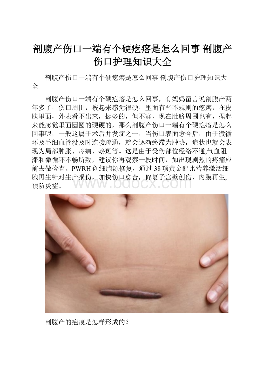 剖腹产伤口一端有个硬疙瘩是怎么回事 剖腹产伤口护理知识大全.docx