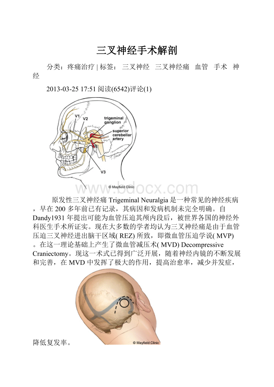 三叉神经手术解剖.docx