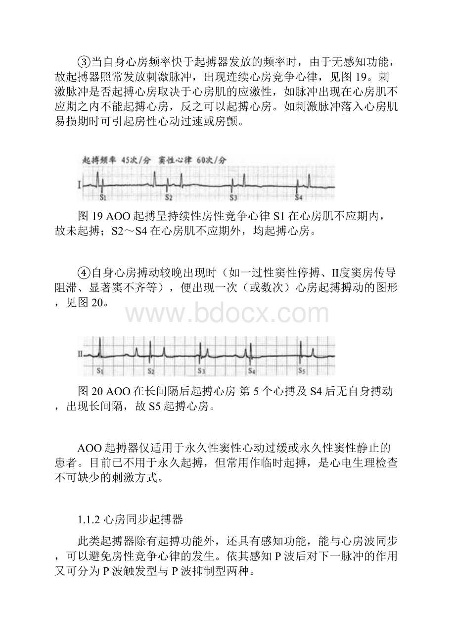 各类型起搏器的心电图特点.docx_第3页