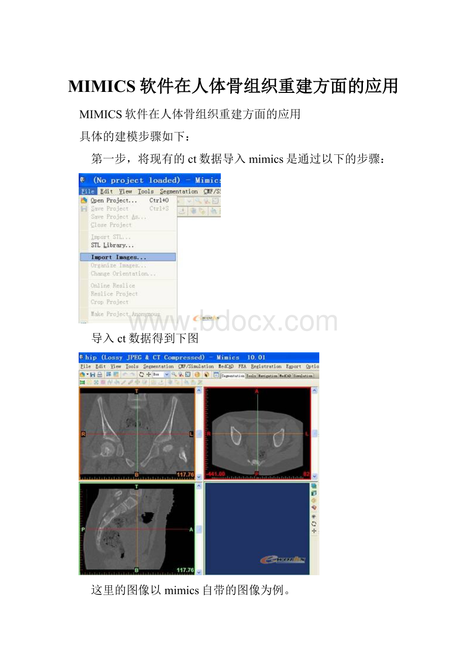 MIMICS软件在人体骨组织重建方面的应用.docx