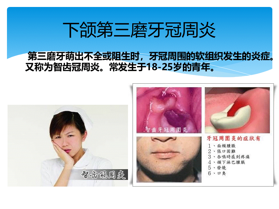 常见口腔科疾病PPT课件.ppt_第3页