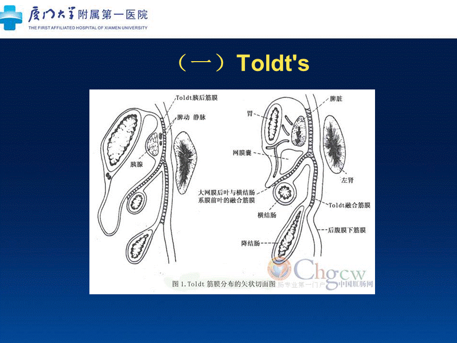 左半结肠的微创解剖及临床意义.ppt_第3页