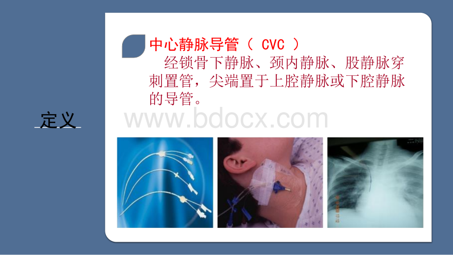 CVC及PICC的护理-.pptx_第3页