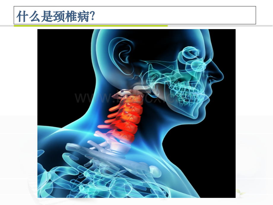 颈椎病康复治疗ppt课件.ppt_第3页