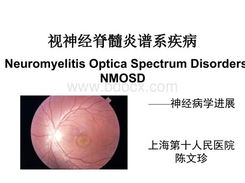 视神经脊髓炎谱系疾病-陈文珍.ppt