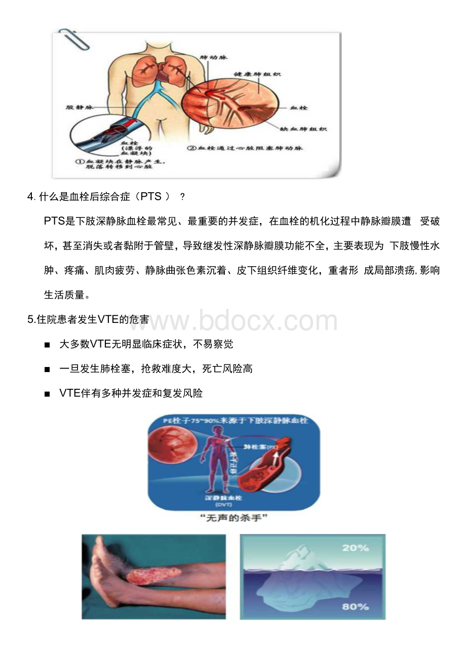 VTE健康宣传手册.docx_第2页